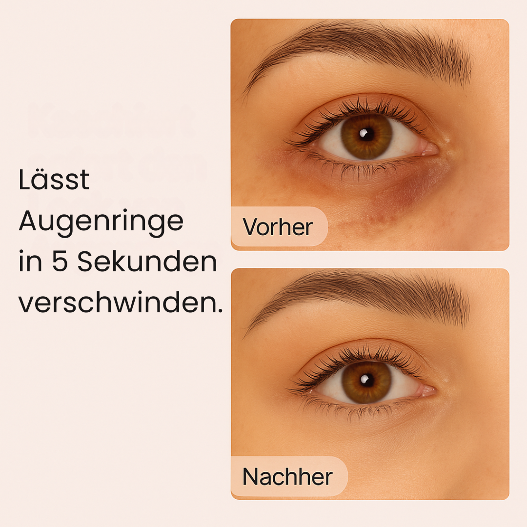 Élan d’Or™ - Premium Augenringaufheller