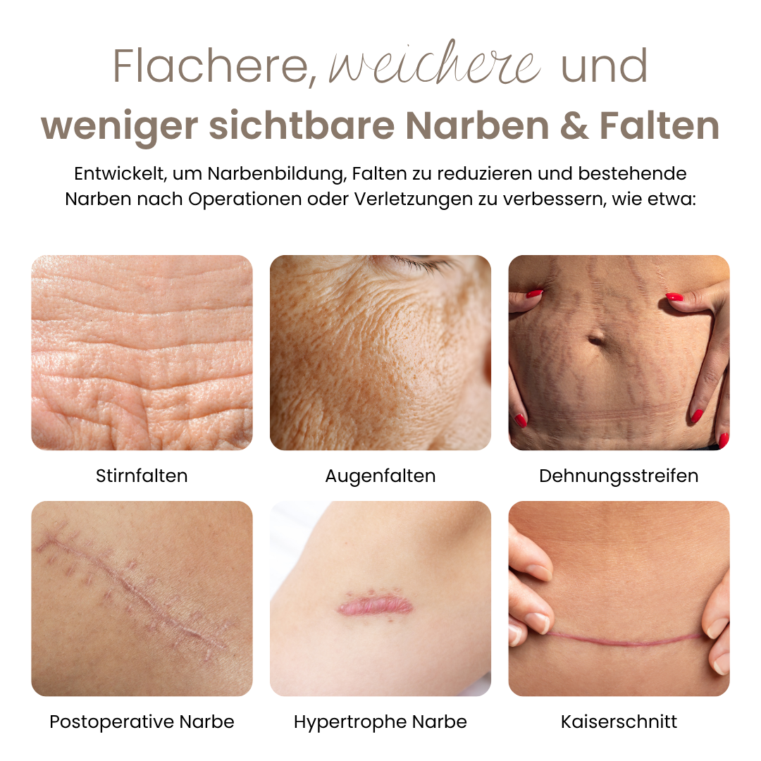 DermaSil™ — Silikon Narbenpflege-Stick