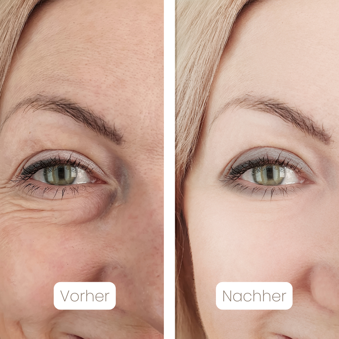 DermaSil™ — Silikon Narbenpflege-Stick