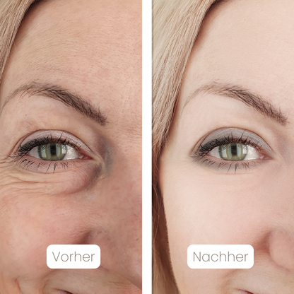 DermaSil™ — Silikon Narbenpflege-Stick